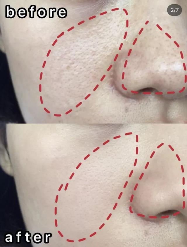 张韶涵澳洲玲珑面膜,张韶涵护肤敏感肌