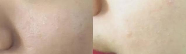 最好用的大牌定妆粉推荐,热门平价定妆粉