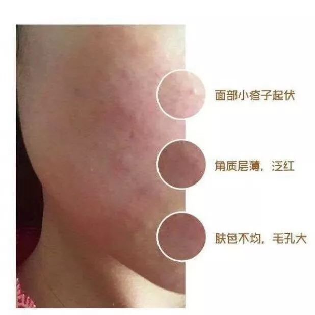 paso面膜,paso护肤品怎么样