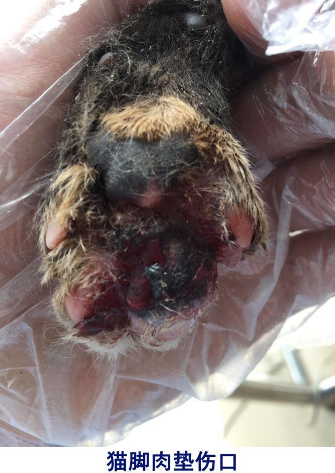 激光治疗脚跖疣方法,激光治疗脚垫视频