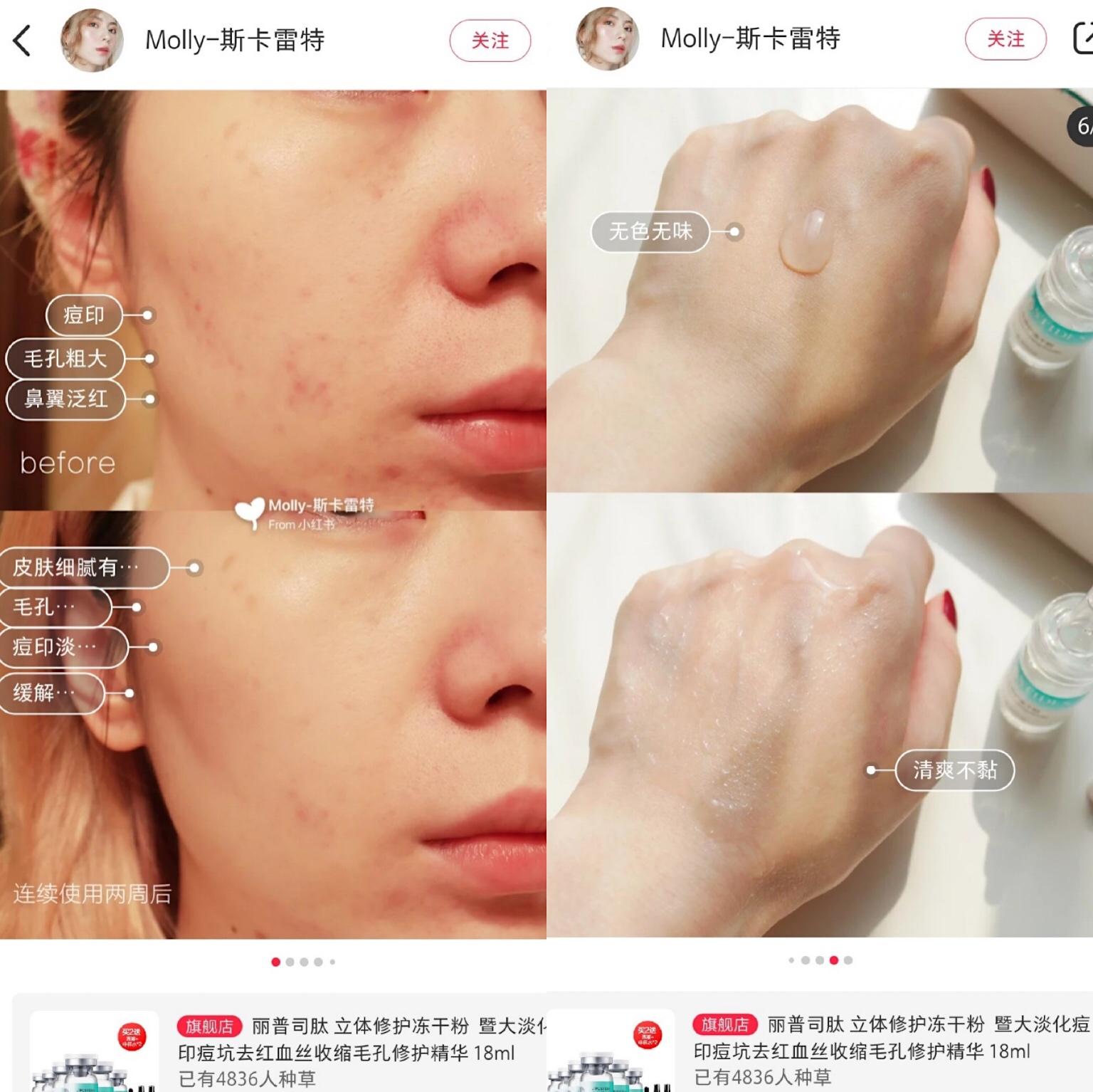 丽普司肽对痘痘好用吗,丽普司肽冻干粉成分表