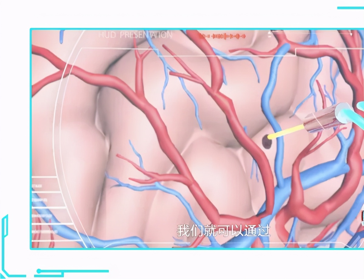40多岁记忆力下降是痴呆的征兆吗,怎么分辨记忆力下降和老年痴呆