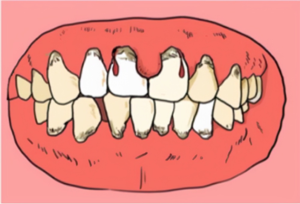 一招解决所有口臭,一招解决口臭困扰