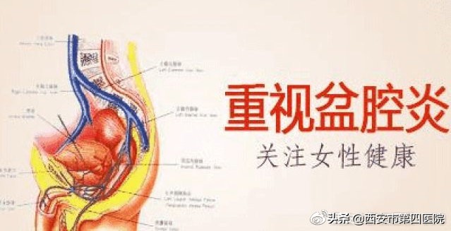 月经后盆腔炎严重怎么回事,盆腔炎是怎么回事儿