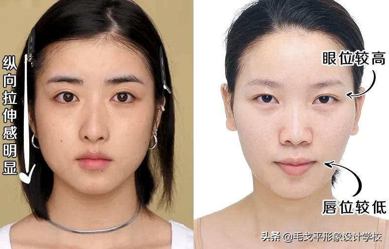 3步缩中庭摆脱老气变年轻,中庭过长的四个变美思路