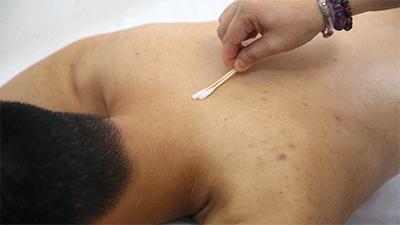 一看就会手把手教拔罐疗法,学拔罐视频教程全集