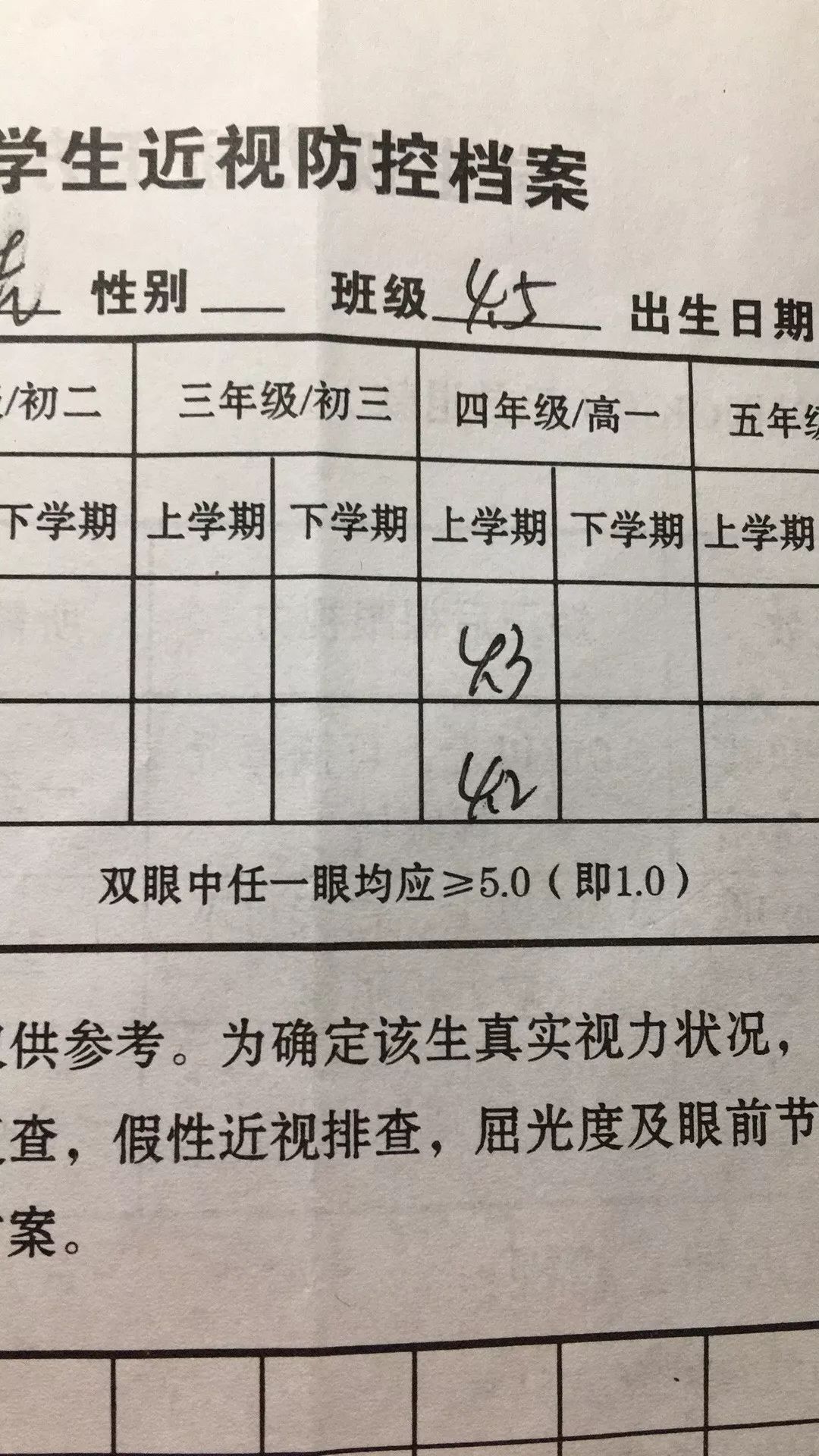 孩子20度斜视加近视,孩子100度近视又有斜视如何挽救