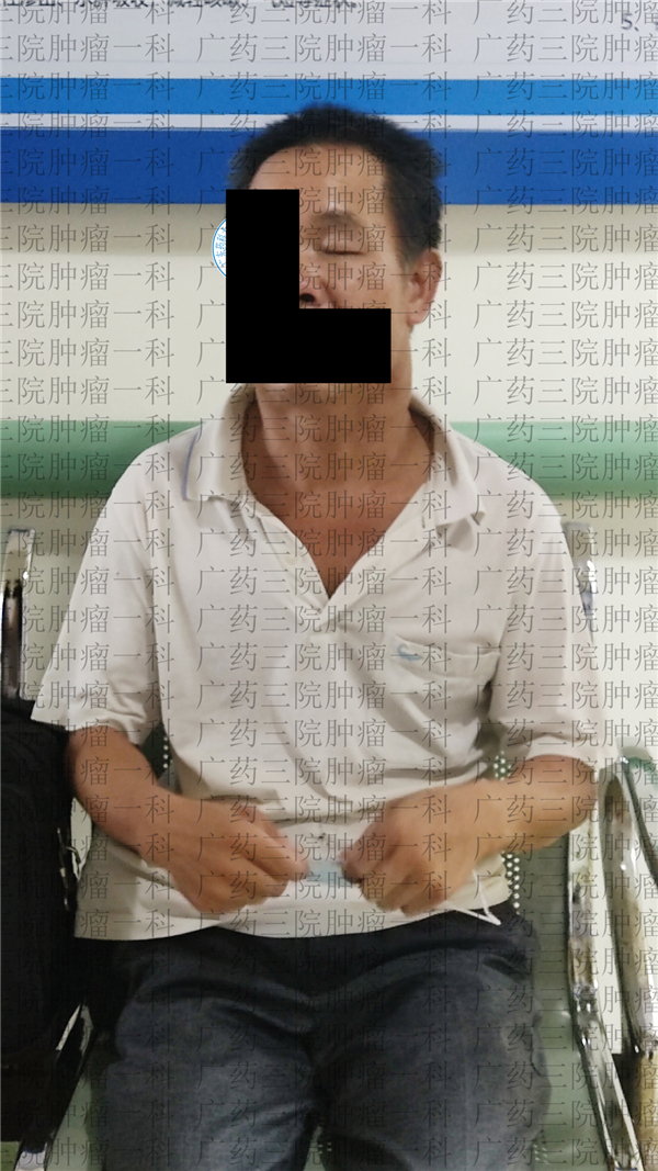 广药三院肿瘤一科,广药三院肿瘤综合治疗中心