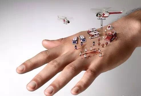 红点消失后皮肤变成褐色,红点出现又消失