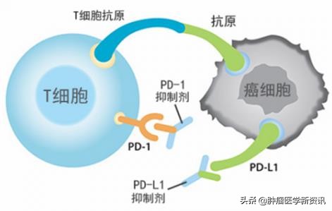 癌症组织学分级3级严重不,癌症组织学分级意义