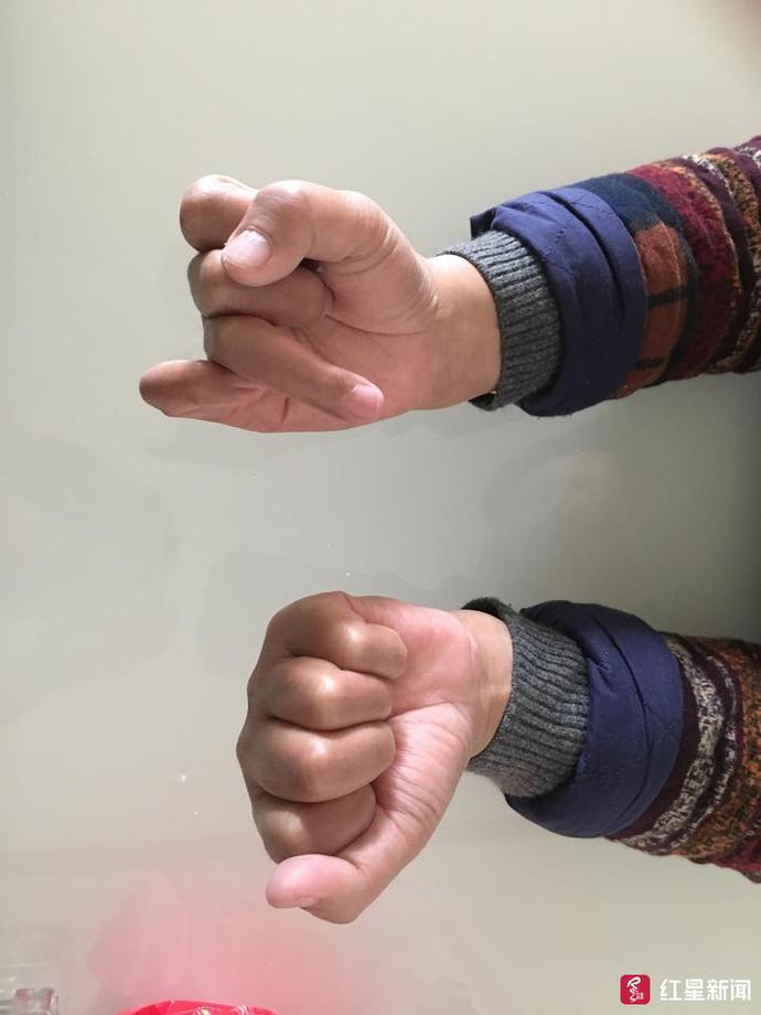 女子车祸身亡赔偿60万,女子车祸1个月后流产索赔6万获2千