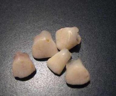 上牙埋地下，下牙扔房顶，孩子乳牙掉了别再这么做了