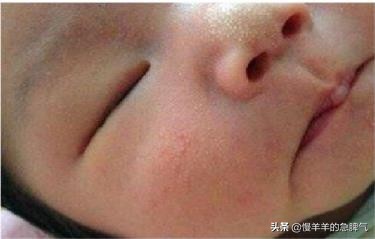 新生儿正常生理现象,新生儿正常生理现象哪四个