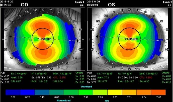遵义哪家医院可以测视力,目明尔来青少年视力矫正中心