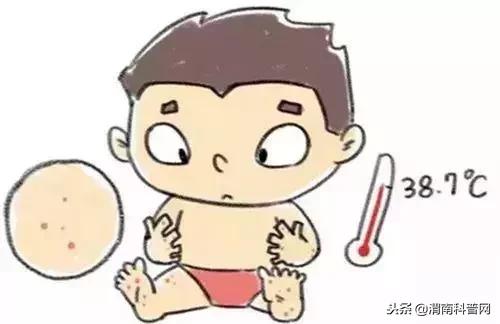 水痘基本知识图解,学校水痘的防控措施