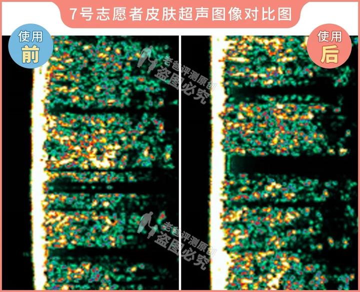 300块的网红美容仪有效果吗,网红家用美容仪测评