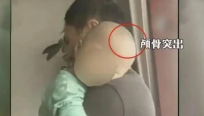 湖南郴州大头孩儿,湖南郴州大头娃娃视频