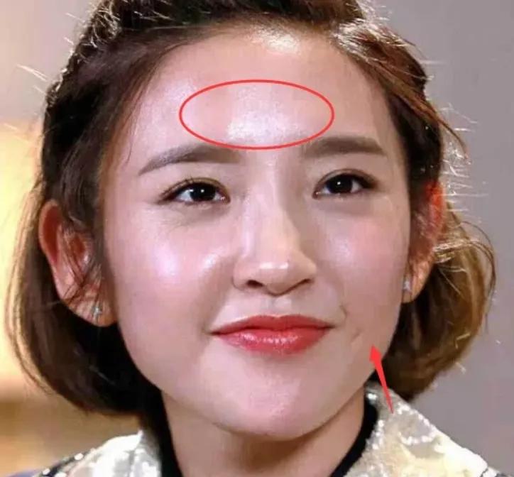 青春期女生总是“油光满面”若能坚持这3习惯轻松远离大油田