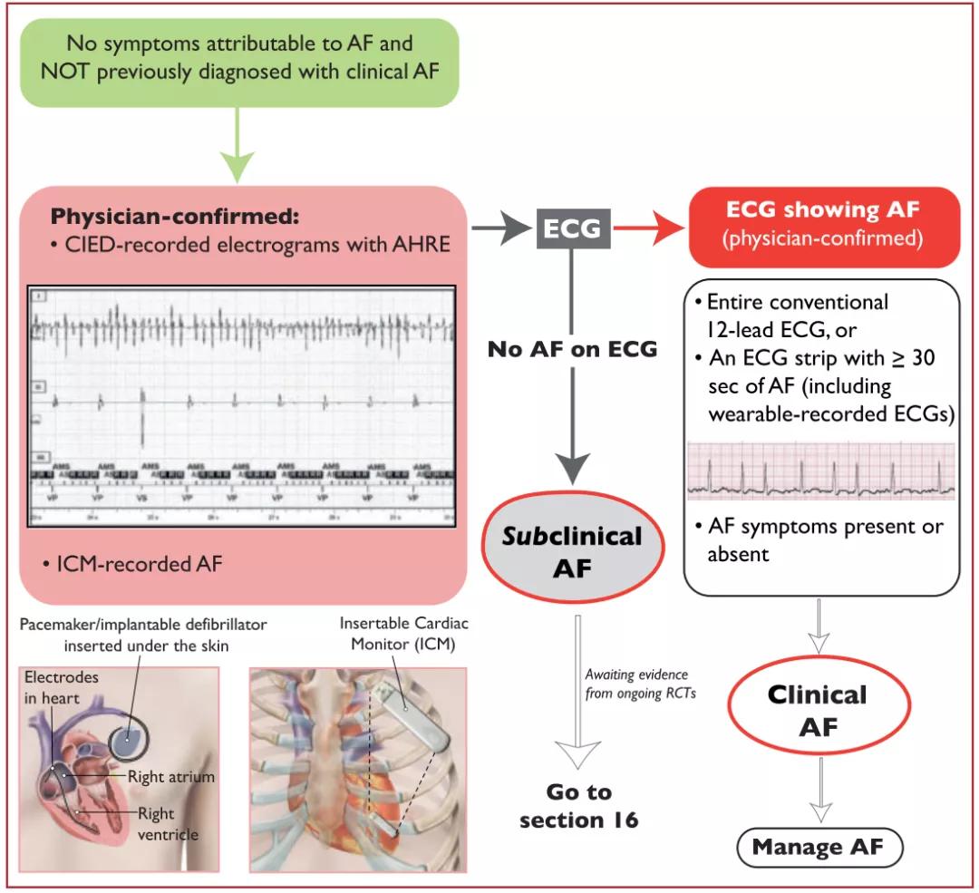 2020年欧洲心脏病学会房颤指南,国际最新房颤标准