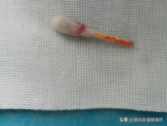 青少年有血尿怎么回事,青少年突然尿血和便血是怎么回事