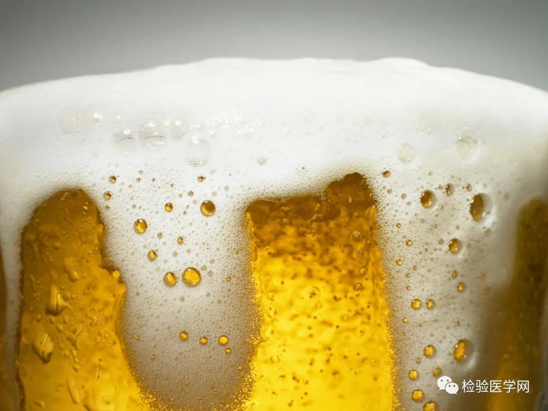 尿里飘着油花是怎么回事,尿里漂了一层浮沫像啤酒沫