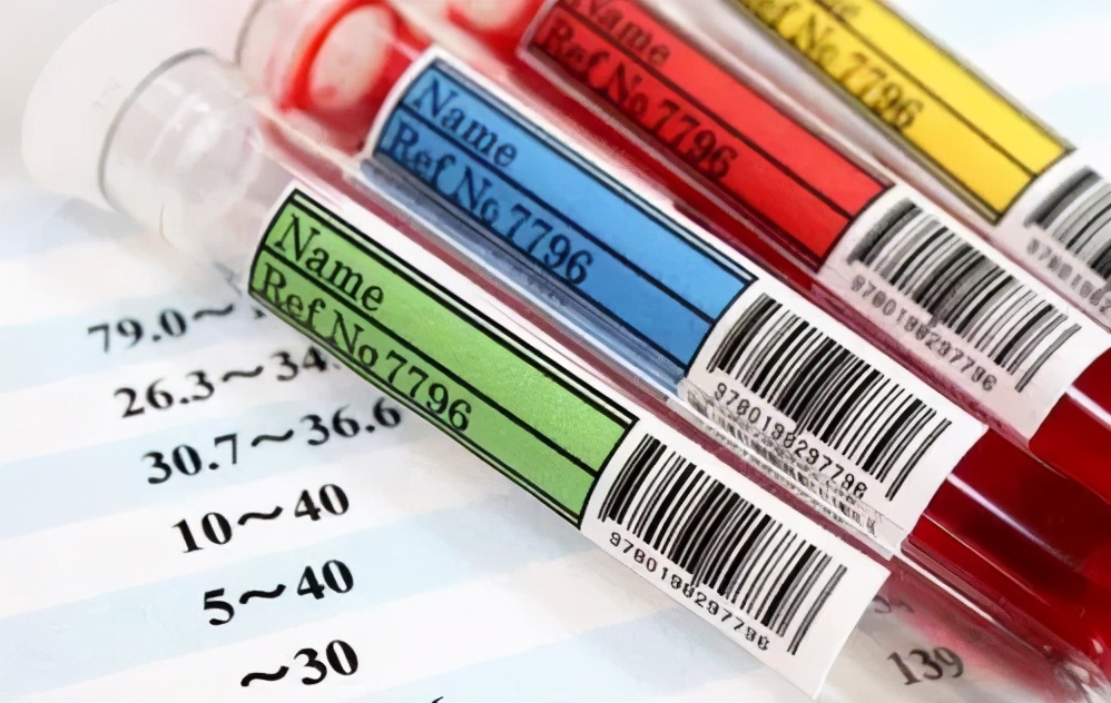 体检哪些项目不值得做,这些体检项目套路深别花冤枉钱