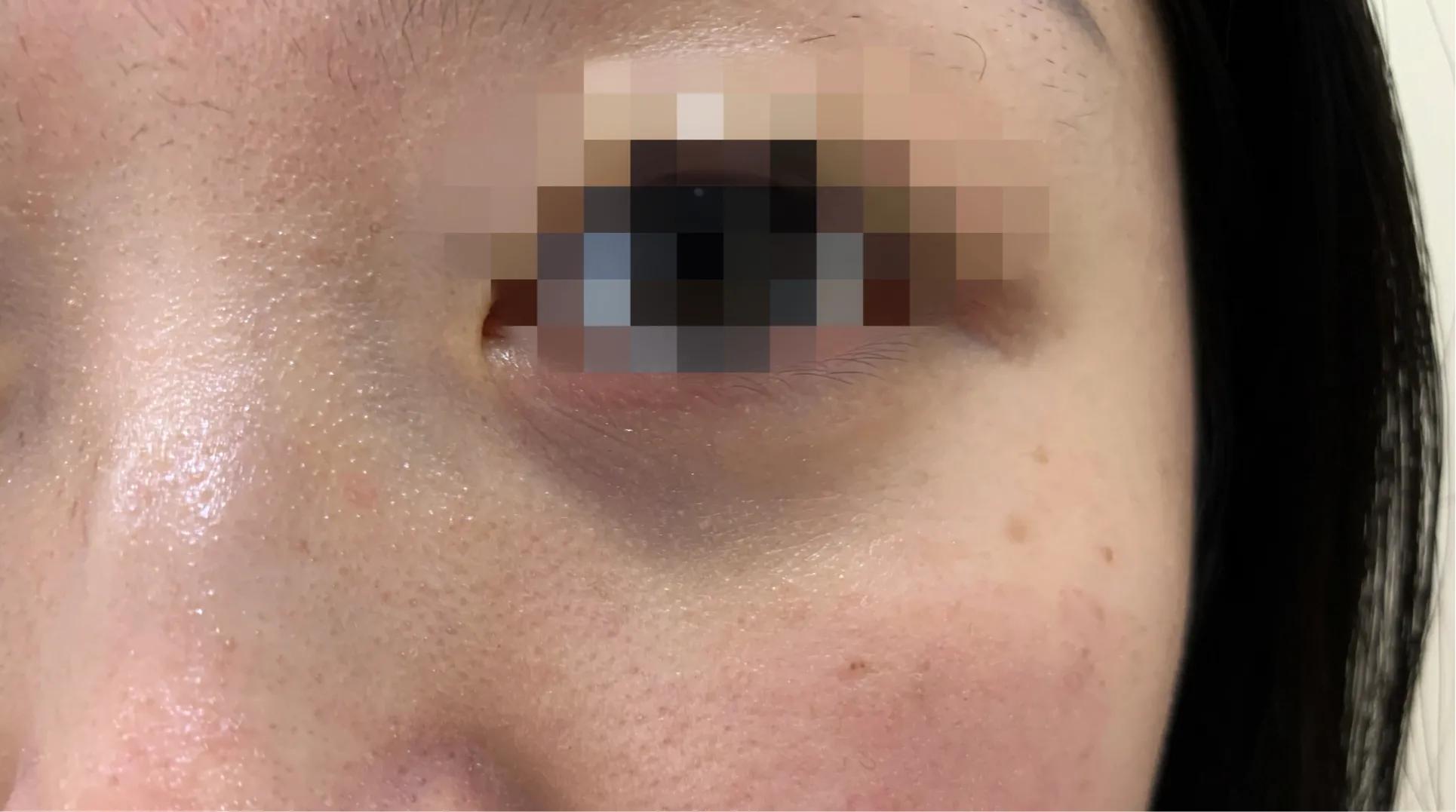 很有效的去除黑眼圈的方法,消除黑眼圈的有效日常方法