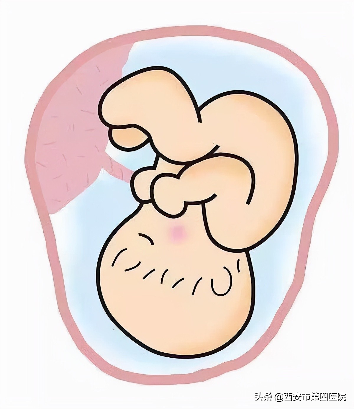 健康中国2030预防大于治疗,健康中国行动新生儿科
