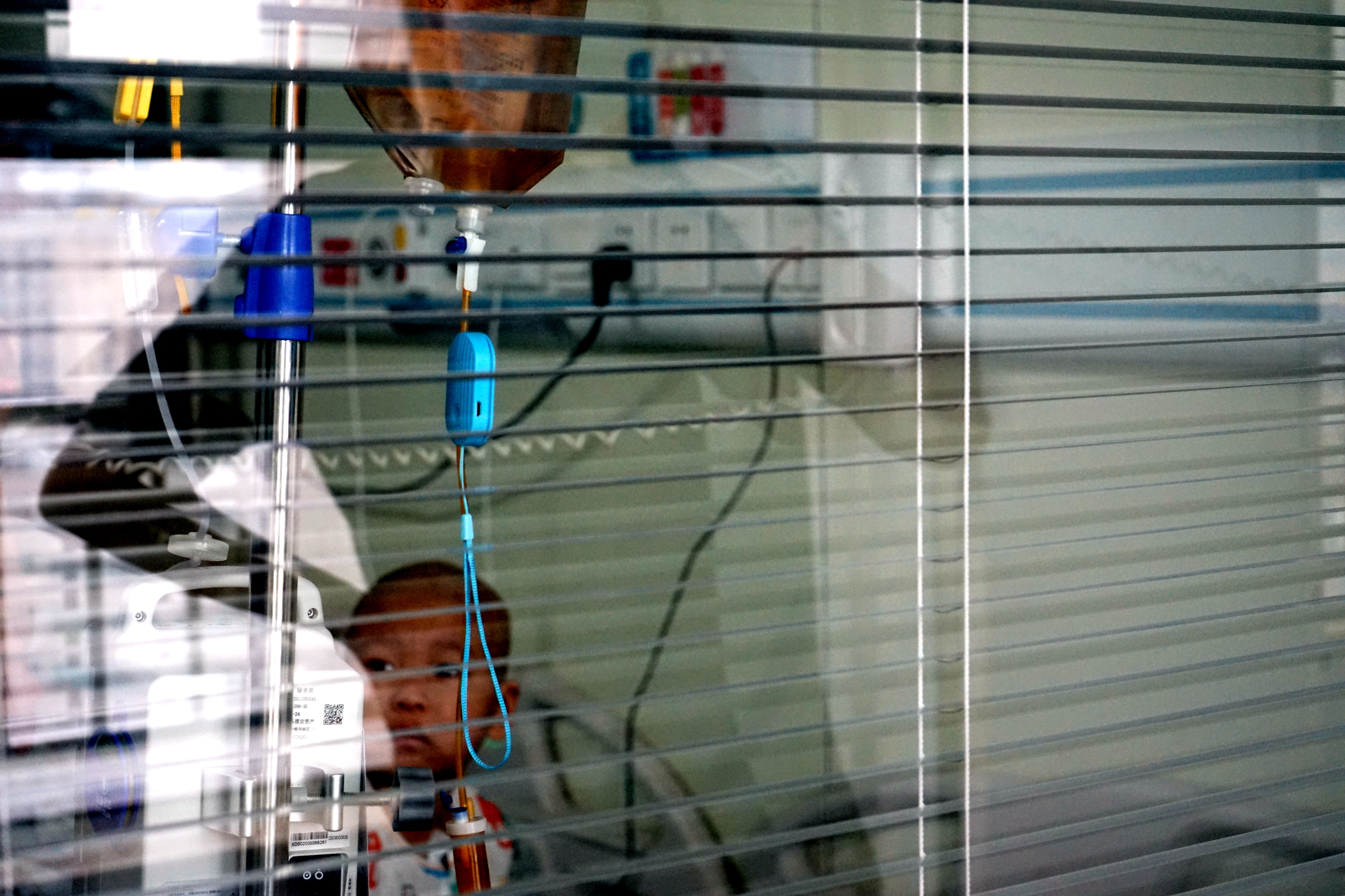 湖北4岁女孩生病致脸部毁容，需“割肉”治疗，爸爸门外放声大哭