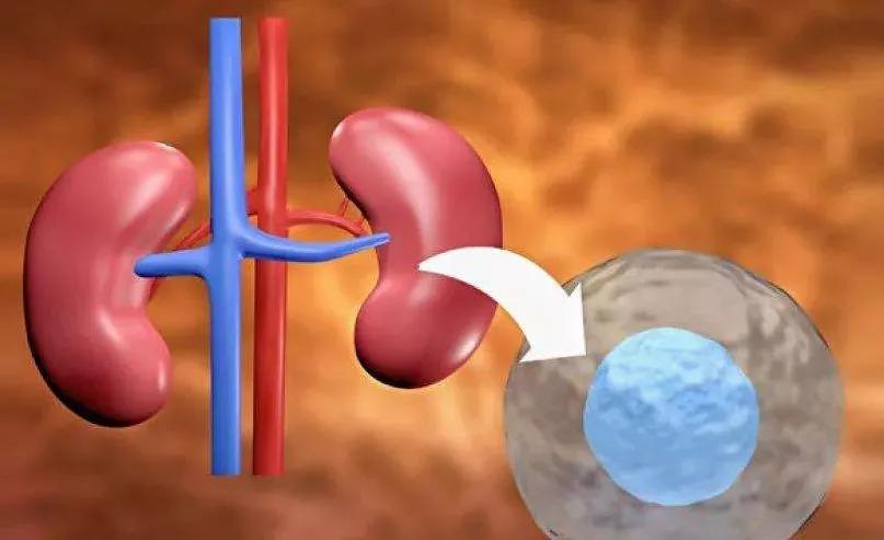 干细胞能治好慢性肾病吗,干细胞治疗肾病有哪些副作用