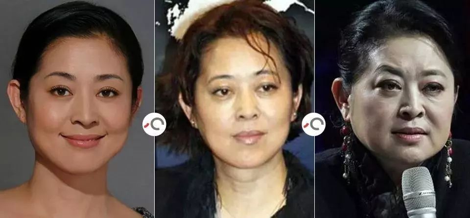 法令纹显老10岁三种方法帮助改善,最显老的法令纹怎么改善