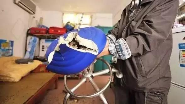 升降椅自爆女子被“*菊爆**”肠道取出多枚碎片!警惕屁股下的椅子