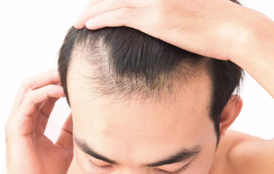 头皮养护体验馆高级,头皮养护线上营销方案