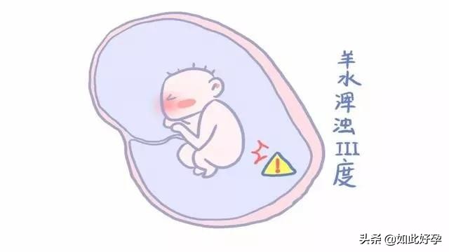 孕期几个月开始注意羊水问题,羊水漏了一点不漏要马上去医院吗