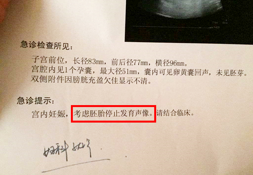 怀孕10周未见胚芽和胎心搏动,孕10周看不到胎心胎芽怎么回事