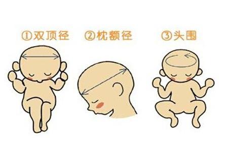 孕期B超检查单怎么看，帮你解惑B超问题