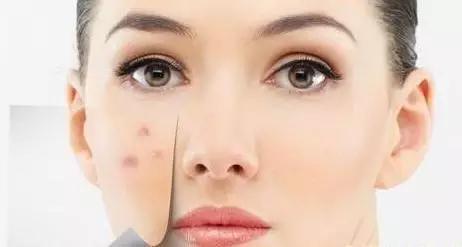 如何轻断食祛痘,酵素祛痘用法