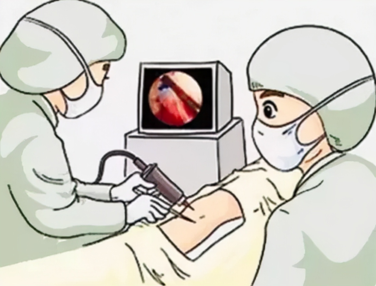 关节镜的适应症是什么,关节镜操作流程及注意事项