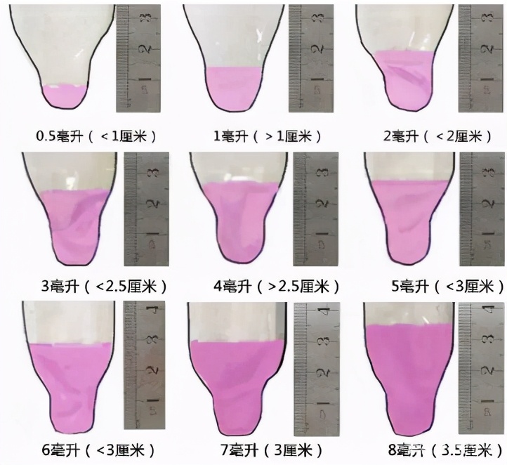 100个精子有20个正常精子有问题吗,严重少精子症只有十几个精子