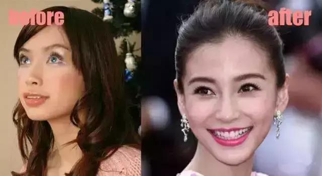 嘴型丑的怎样让嘴唇变得好看,嘴型不好看怎么练才能矫正