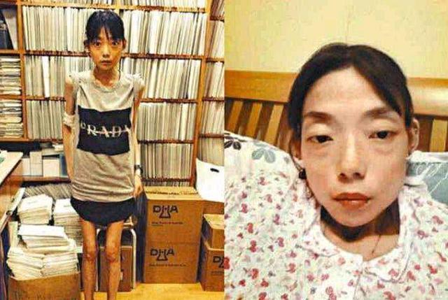 伍智恒暴瘦原因,伍智恒告别豪门阔太