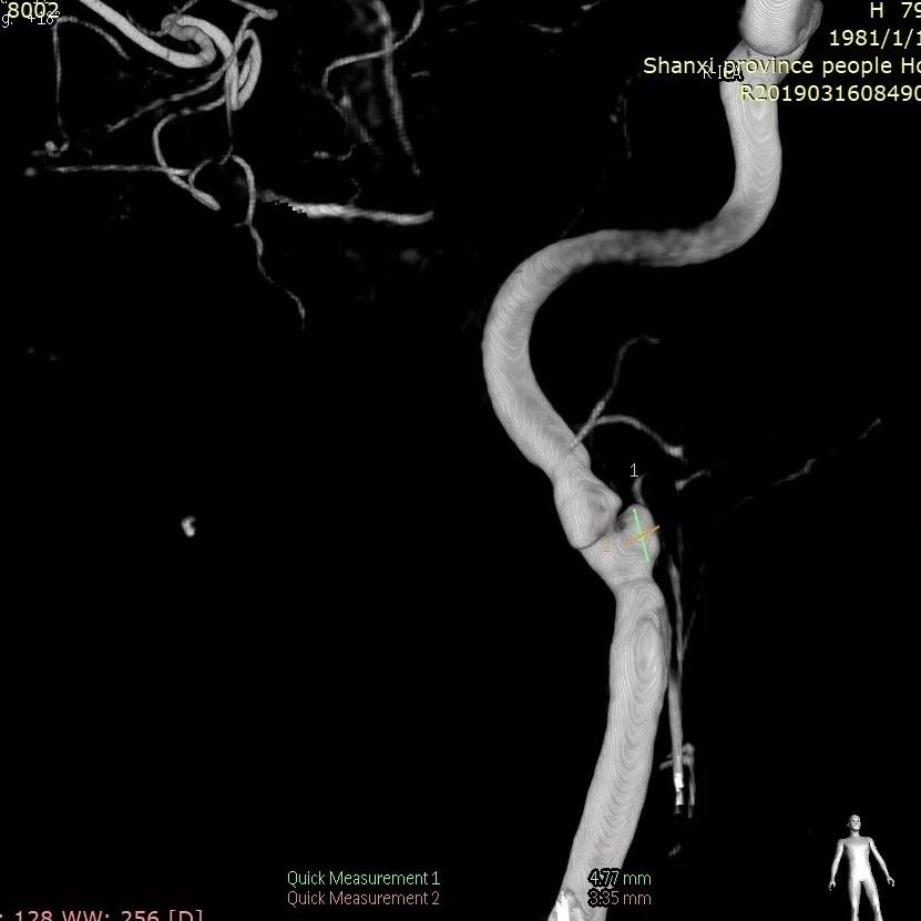 山西省人民医院任少华教授,山西省人民医院任少华