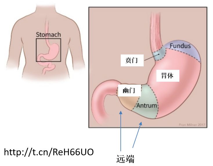 幽门螺旋杆菌胃病吃什么可根除,幽门螺旋杆菌阳性中医怎么调养