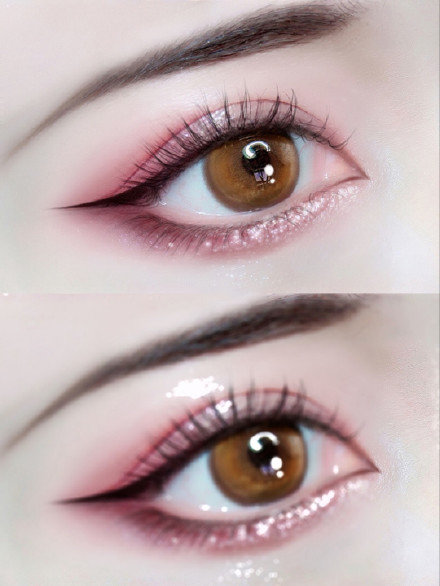 关医生整形,整形双眼皮有哪几种