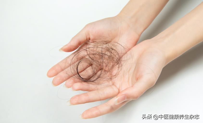 掉多少根头发就属于严重脱发了,掉头发多少算脂溢性脱发