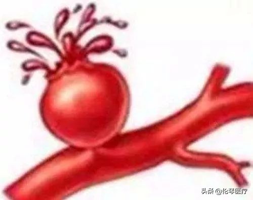 突然肚子疼痛要做什么检查,突然肚子疼要做ct吗