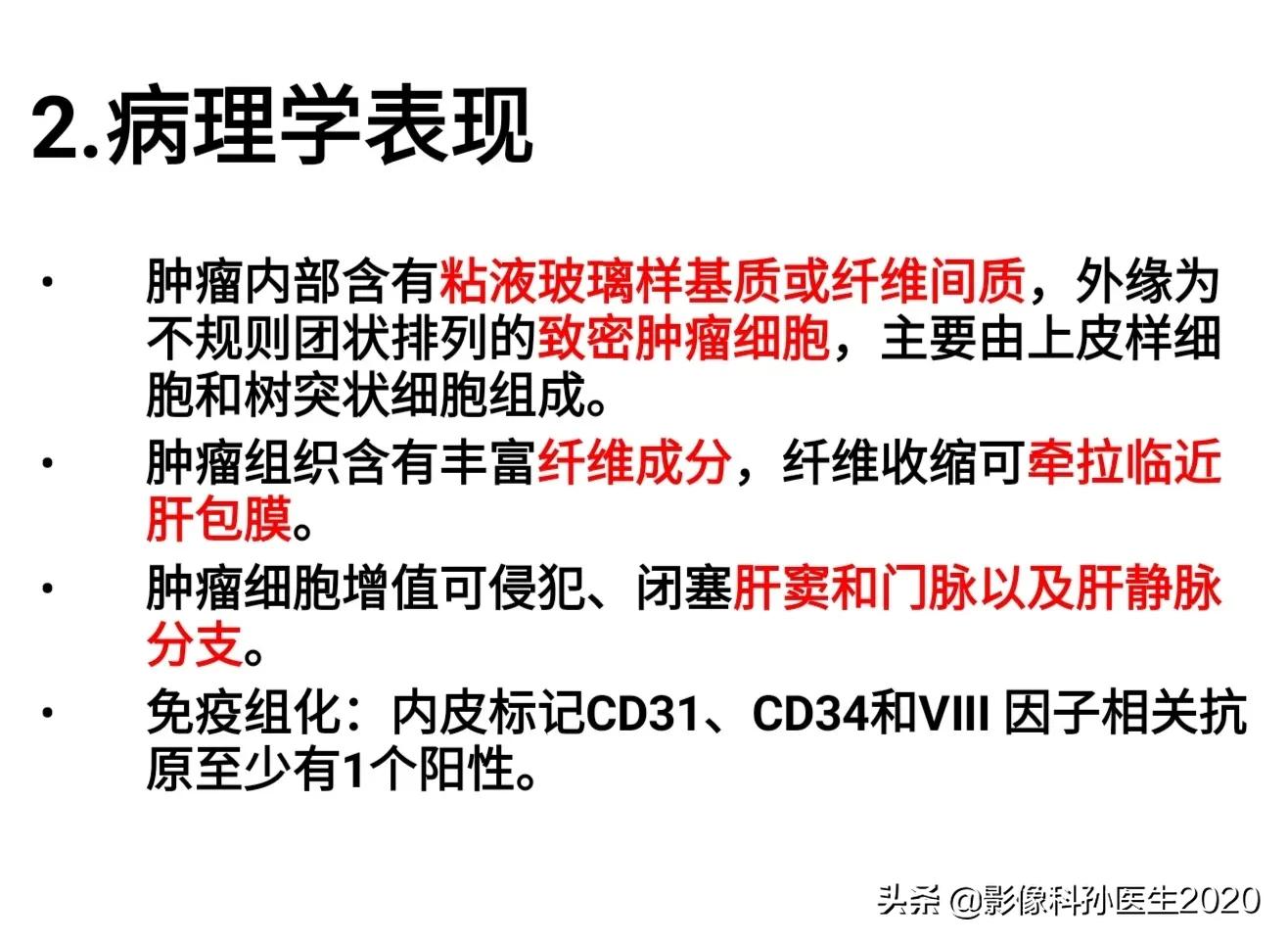 肝上皮样血管内皮瘤全国多少例,肝上皮样血管内皮瘤超声表现