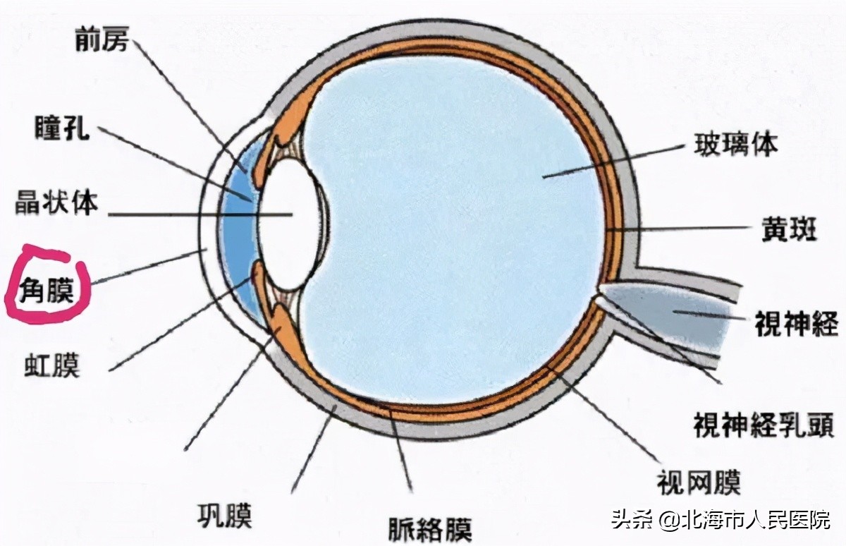 飞虫进入眼睛角膜受伤,飞虫进角膜怎么办