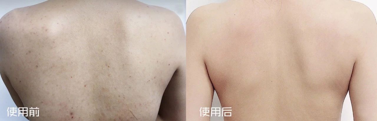 用羊奶洗脸一天能洗几次,用羊奶洗脸好吗