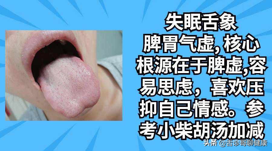 各种舌象分析病情,舌诊哥是如何治疗病人的